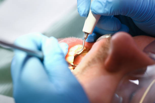 Best Weekend Emergency Dentist in Newhall, IA