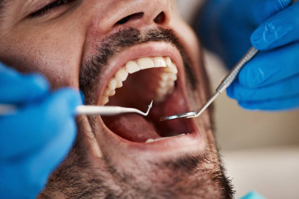 Best Pediatric Emergency Dentist in Newhall, IA